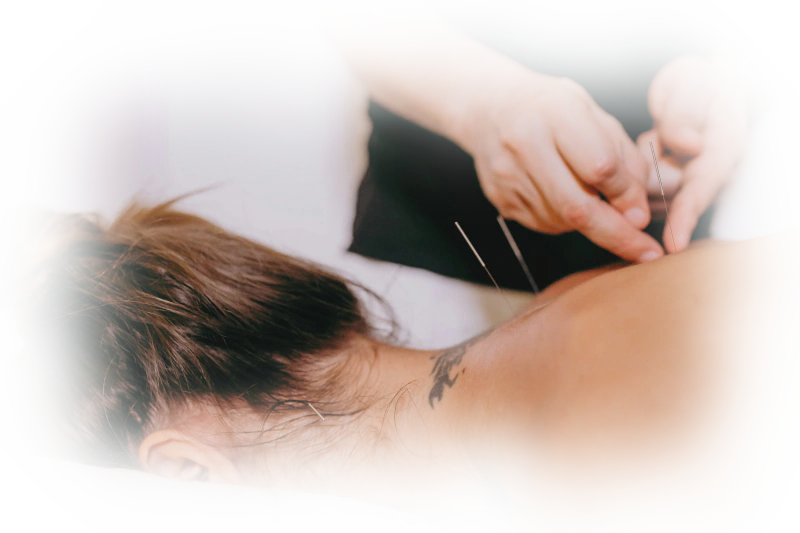 ☀️ Pourquoi l'Acupuncture 针灸 ?
